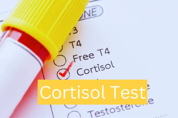 Cortisol Test beim Heilpraktiker Witten