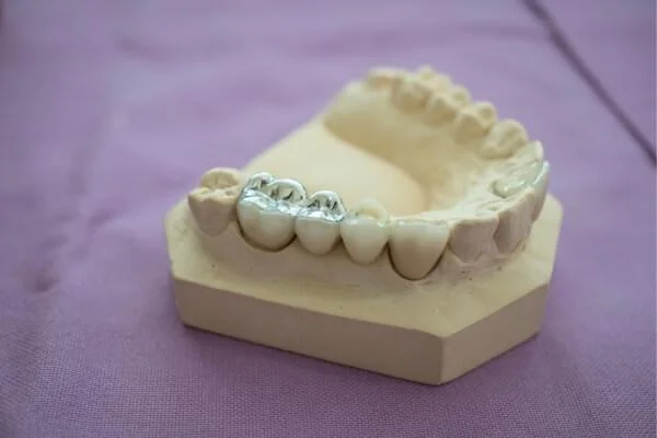 Amalgam ausleiten