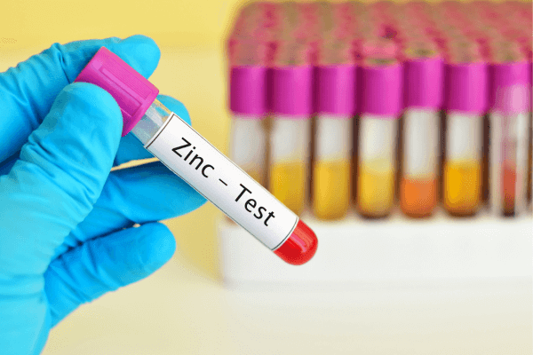 Zinkmangel Test